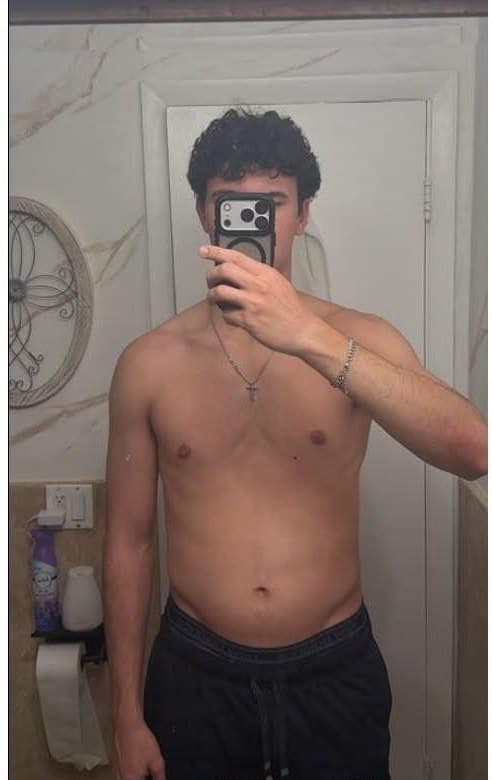 Alex before